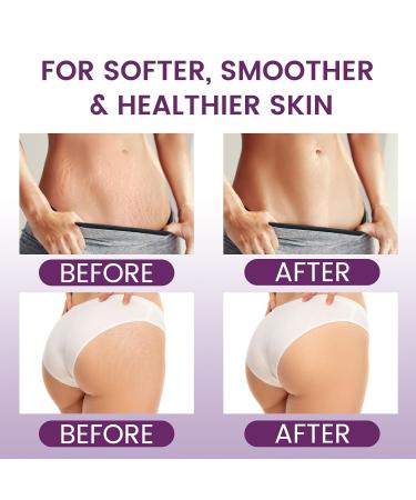 AOAO Stretch Mark Butter for Pregnancy | Body Balm for Women with Shea Butter & Vitamin E | Paraben-Free Formula for Scars & Stretch Mark Repair | Belly Butter for Pregnant Women (Shea Butter_1) - Buy Online on GoSupps.com