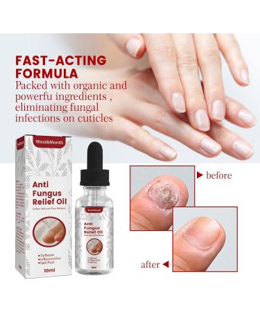 Quick Relief Oil Fungal Nail Treatment Rapid Relief Oil Nail Fungus Treatment For Toenail Nail Treatment Oil Toe Nail Fungal Treatment Onychomycosis Nail Treatment Toenail Repair for Damaged Nails - Buy Online on GoSupps.com