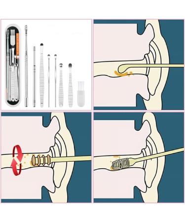 8pcs Stainless Steel Ear Wax Removal Kit - Thorough Ear Cleaning Tool Set - Buy Online on GoSupps.com