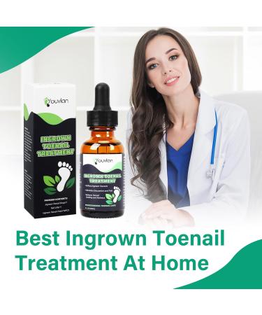 Ingrown Toenail Treatment Kit - Softener Drops Lifter Nail Patches & Tools for Easy Home Care - Buy Online on GoSupps.com