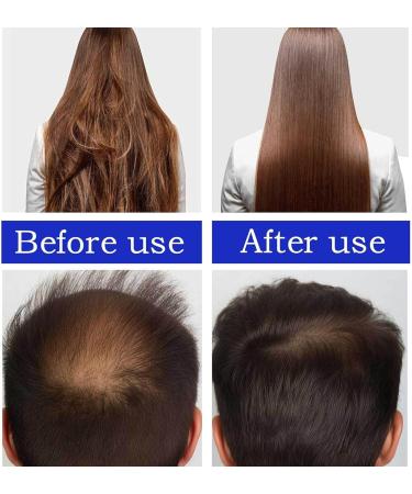 Batana Oil for Hair Growth - Batana Oil - 100% Natural - Promotes Hair Wellness for Men & Women Enhances Hair & Skin Radiance Leaves Your Hair Smoother Oil - for All Hair Types - Buy Online on GoSupps.com