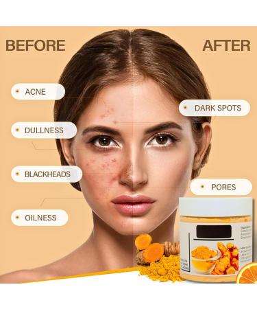 Turmeric Vitamin C Clay Face Mask Turmeric Clay Mask Turmeric Face Mask for Dark Spots Mud Mask Deep Cleansing Face Mask Skin Care Improve Blackheads Acne Dark Spots and Even Out Skin Tone 120g - Buy Online on GoSupps.com
