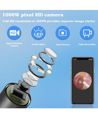 TopQuaFocus Earwax Removal Kit - Electric Otoscope with 6 LED Lights & 1000P HD Camera | Wireless Ear Scope for Kids & Adults | Easy Ear Cleaning & Pediatric Wax Remover - Buy Online on GoSupps.com
