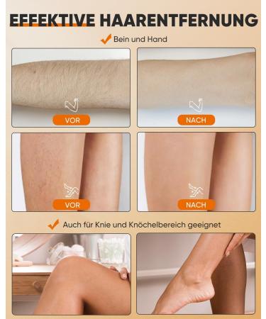 Nano Crystal Hair Remover - Gentle Hair Removal Stone for Arms Legs Back & More | No Shaving Needed - Perfect for Women - Buy Online on GoSupps.com