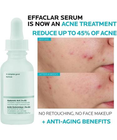 Hyaluronic Acid 2% + B5 Face Serum Face Moisturiser Hyaluronic Acid For Face Hydrated Face Serum for Women & Men to Plump & Smooth Skin Brightening Serum for Blemish-Prone Dull Skin (01) - Buy Online on GoSupps.com