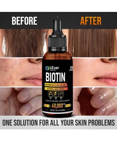Liquid Biotin & Collagen Drops with Aloe Vera Unique Formula 60 000 mcg - Vitamins for Hair Growth support Strong Nails & Radiant Skin Liquid Collagen Supplement for Women & Men 2 fl oz - Buy Online on GoSupps.com