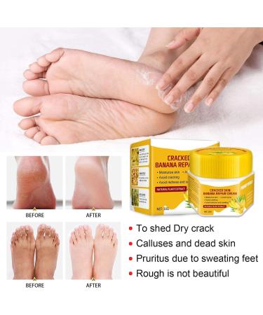 Banana Repair Foot Cream Banana Foot Repair Skin Healing Moisturizer 30 Vitamin E Foot Cream for Cracked Heels and Dry Feet - Buy Online on GoSupps.com