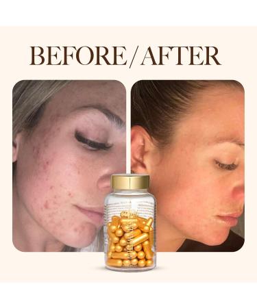 edandi Skin Within Hair Skin & Nails Collagen Natural Dietary Supplement with Vitamin C and Marine Collagen, 30 Day Supply, 60 Capsules - Buy Online on GoSupps.com