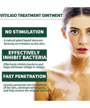  Utapossin Anti-blemish cream delicate herbal extract removes dark spots anti-melanin whitens easy to apply improves skin pigmentation - Buy Online on GoSupps.com