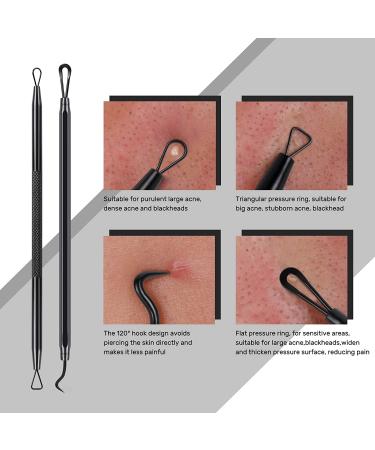 Jolifile 7-Piece Blackhead Removal Set | Acne Comedone Extractor Tools | Blackening Remover & Pimple Popper Tweezers - International Shipping Available - Buy Online on GoSupps.com