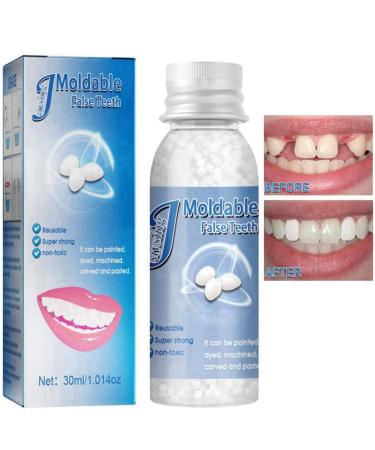 Tooth Repair Kit DIY Fake Teeth Repair Beads for Temporary Fixing Tooth Filling Repair Kit Temporary Tooth Filling Teeth Repair Kit Temporary Tooth Filling Kit Tooth Repair Kit for Broken Tooth