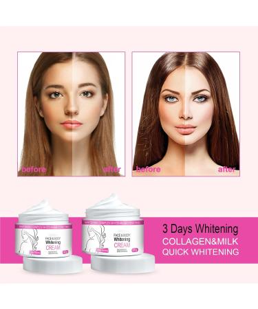 Face and Body Whitening Cream Dark Skin Permanent Bleching Cream Lightening Cream for Dark Skin Whitening Cream Dark Skin Whitening Cream Bleaches And Brightens The Underarm Body 30G - Buy Online on GoSupps.com