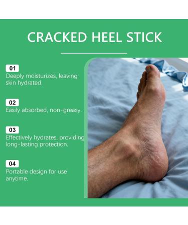  BRVLY Heel balm with 60% urea (maximum effectiveness) - Moisturizing foot care with vitamin E and aloe vera ideal for dry and cracked heels Heel repair (1) - Buy Online on GoSupps.com