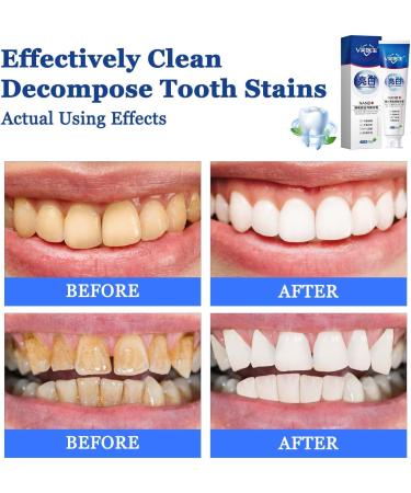 Smile Doctor SP-4 Toothpaste | Ultra Rapid Whitening & Fresh Breath | 2 Pcs for Tartar Prevention | International Shipping Available - Buy Online on GoSupps.com