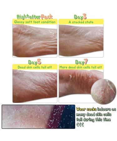 Elizavecca Witch Piggy Hell-Pore Turtle Foot Pack - Exfoliating & Moisturizing (1 Pair, 1.41 oz) - Buy Online on GoSupps.com