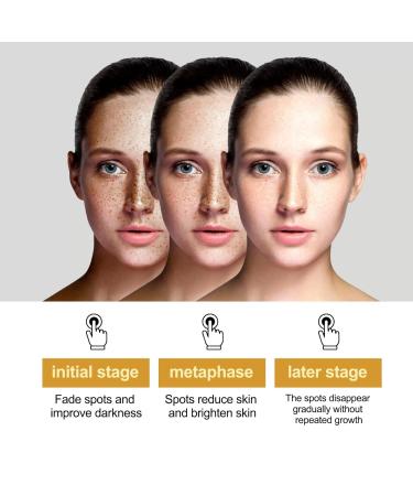 Kasumi Abera Whitening Cream - Japanese Premium Face Cream for Dark Spot Reduction | Suitable for All Skin Types | 1PCS - Buy Online on GoSupps.com