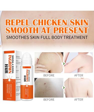 Fashion Base Ingrown Hair Treatment Roll-On - Reduce Razor Bumps and Ingrown Hairs - Soothing Serum for Ingrow Solutions - After Shave Ingrown Hair Reduction - Buy Online on GoSupps.com