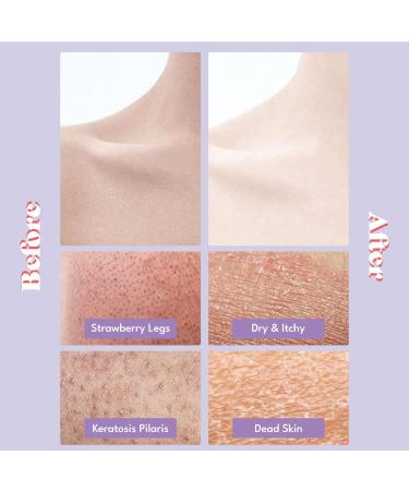 Toi L Gentle Touch Bubble Peeling Body Pad (5 Pads) - Exfoliating Mitt for Body with 5-Berry Complex - Buy Online on GoSupps.com