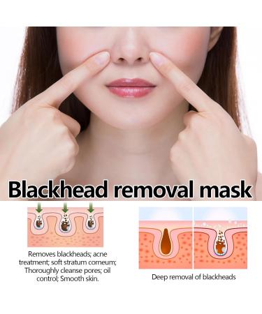 Blackhead Remover Mask - Peel Off Charcoal Face Mask for Deep Cleansing | Acne & Pore Control for Men & Women - Buy Online on GoSupps.com