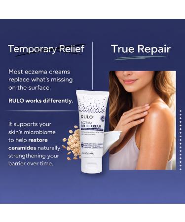 RULO Eczema Relief Cream | Clinical-Strength Itch Relief & Dermatitis Treatment for Adults Baby and Kids | Advanced Eczema Therapy and Skin Barrier Repair Colloidal Oatmeal for Itchy Skin | 2 Fl Oz - Buy Online on GoSupps.com