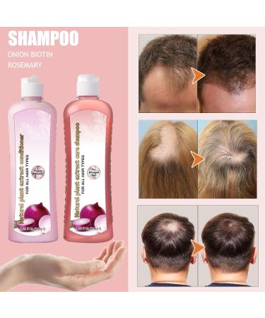 Onion & Rosemary Shampoo for Hair Growth | Biotin Anti Hair Loss Shampoo 16.76 fl oz - Buy Online on GoSupps.com