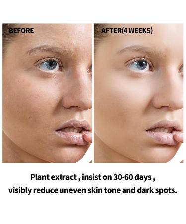 ANAI RUI Squalane Rosehip Oil for face +Vitamin C Turmeric Oil Hydrate Firm and Softer Skin - Buy Online on GoSupps.com