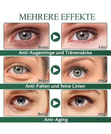 Eveellyn Eye Pads - 60pcs Aloe Vera & Hyaluronic Acid Eye Masks for Dark Circles Wrinkles Puffiness & Tear Bags - Buy Online on GoSupps.com