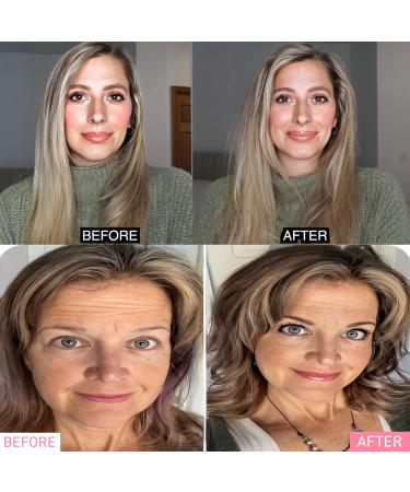 8PCS Volumizing Hair Clips - Velcro Clips for Root Volume | Volumizing Hair Products for Extra Volume - Buy Online on GoSupps.com