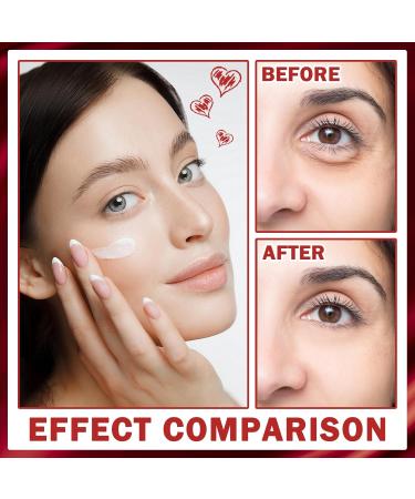 Buy Retinol Cream for Face - Hydrating Night Cream & Facial Moisturizer for Under Eye - Best International Shipping - Buy Online on GoSupps.com
