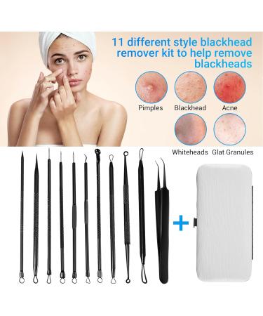tesrgre Blackhead Remover Pimple Popper Tool Kit 11 Pcs Pimple Extractor Tool Acne Kit for Blackhead - Buy Online on GoSupps.com