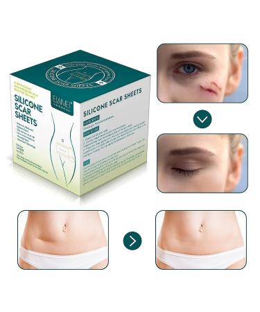 Silicone Scar Sheets 1.6x120 Roll-3M | Reusable Silicone Strips for Surgical Scars | Effective Scar Removal for C-Section, Keloid, Burn, Acne, Tummy Tuck - Buy Online on GoSupps.com