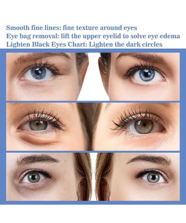 Buy Lumilight Eye Cream - Snake Venom Peptide Anti-Wrinkle Serum for Tightening Firming & Smoothing Fine Lines (3 PCs) - International Shipping Available - Buy Online on GoSupps.com