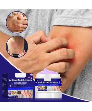 Gentle 30g Itch Relief Cream with Violets Cnidium Extract - Anti-Itch Ointment for Sensitive Dry Skin - Buy Online on GoSupps.com