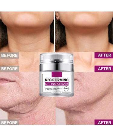 Grospe Firming Neck Cream Collagen & Hyaluronic Acid Anti Aging Neck Creams for Tightening and Firming Visibly Reduces Wrinkles Sagging Skin Neck Firming 1.7 Fl.Oz - Buy Online on GoSupps.com