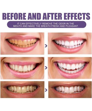 3 Days Teeth Whitening Pearl Probiotic Tooth Powder Has Refreshing Taste Refreshing Mint Flavor Effective Teeth Whitening Remove Stains (1pc) - Buy Online on GoSupps.com