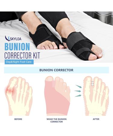 Bunion Corrector Orthopedic Big Toe Separator for Men & Women - Bunion Relief & Straightening Splint for Hallux Valgus Foot Care - Buy Online on GoSupps.com