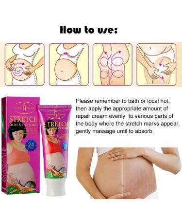 AICHUN BEAUTY Stretch Marks Cream with Snail Extract | Reduce Scars & Repair Damaged Skin | 120g - International Shipping Available - Buy Online on GoSupps.com