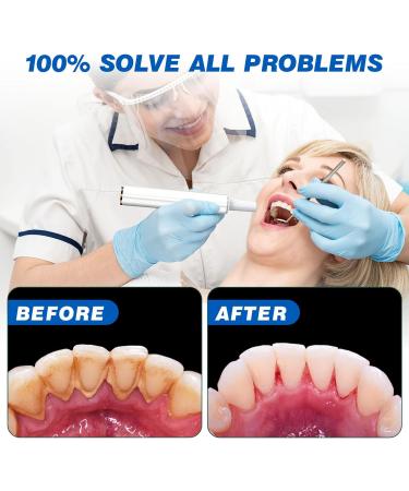 HassoKon Teeth Cleaning Kit - 4 Modes, 4 Heads (White) | Dental Care Set - Buy Online on GoSupps.com