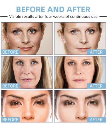 Boto Face Serum Boto Stock Anti Aging Serum For Face Reduce Wrinkles Boost Skin Collagen Anti-Wrinkle Serum Hydrate & Plump Skin 2pc - Buy Online on GoSupps.com