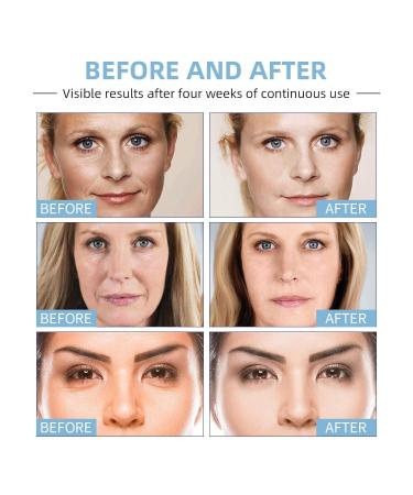 Buy Anti-Aging Botox Facial Serum with Collagen Vitamin E & Amino Acids - Reduce Fine Lines & Wrinkles - Buy Online on GoSupps.com