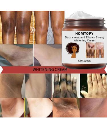 Whitening Cream Whitening Cream For Armpits Brightening Cream For Intimate Parts Of Elbow Bikini And Sensitive Areas Effectively Brightens Melanin - Buy Online on GoSupps.com