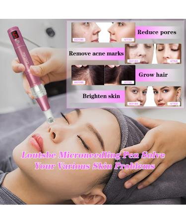 Professional Cordless Electric Microneedling Pen - 21000RPM Dermapen with 30 Replaceable Cartridges - Home Use for Skin Benefits - Buy Online on GoSupps.com