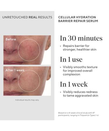 Murad Cellular Hydration Barrier Repair Serum - Hydrating Face Serum Repairs Lipid-Depleted Skin Barrier- Hexapeptide-9 Bilberry and Hyaluronic Acid Delivers Stronger Healthier Skin 1 Ounce (Pack of 1) - Buy Online on GoSupps.com