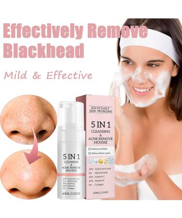 5 in 1 Foaming Cream Cleanser Blackhead Deep Pore Facial Cleansing Mousse Face Cleanser Oily Skin Face Wash with Niacinamide & Hyaluronic Acid Removes Excess Oil Unclogs Pores & Reduces Blackheads - Buy Online on GoSupps.com