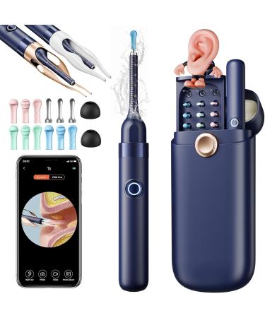 Ear Wax Removal Ear Cleaner with Camera 1296P HD Visual Ear Cleaner with 6 LED Lights and Flexible Tip FSA HSA Eligible Items Safe Ear Wax Removal Kit with Camera Ear Cleaning Tool for Family Gifts Black - Buy Online on GoSupps.com