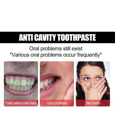 KLYso Professional Teeth Whitening Toothpaste - Deep Cleaning & Stain Removal(1PCS) - Buy Online on GoSupps.com