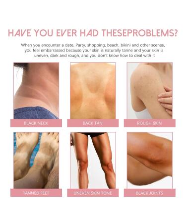 BEROZA 2PCS Cremas Para Las Manchas De La Oscuras en la zona intima 50ml Vitamin C for Body Moisturizing Cream Adecuado para varias reas como axilas cuello zona privada - Buy Online on GoSupps.com