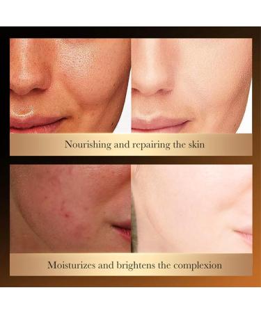 Rice Raw Pulp Face Serum Brightening Serum Face Moisturizer For Women Hydrating Serum Glow Serum For Glow Beauty Skin Barrier Repair Hydrate & Plump Skin With Rice Water Korean Skincare - Buy Online on GoSupps.com