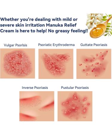 Buy Manuka Honey Eczema Balm - Soothing Relief for Psoriasis Rashes & Itchy Skin - Natural Remedy for Adults & Children - Buy Online on GoSupps.com