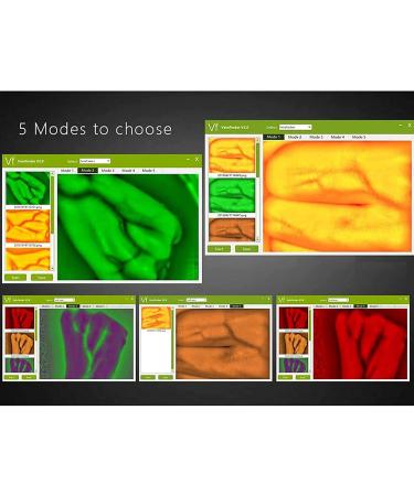 Adjustable Vein Viewers for Nurses | USB Camera Imaging IV for Accurate Venous Access | Ideal for Adults | Enhance Vein Puncture Success - Buy Online on GoSupps.com